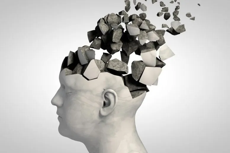 Alzheimer's Disease Memory Loss Concept